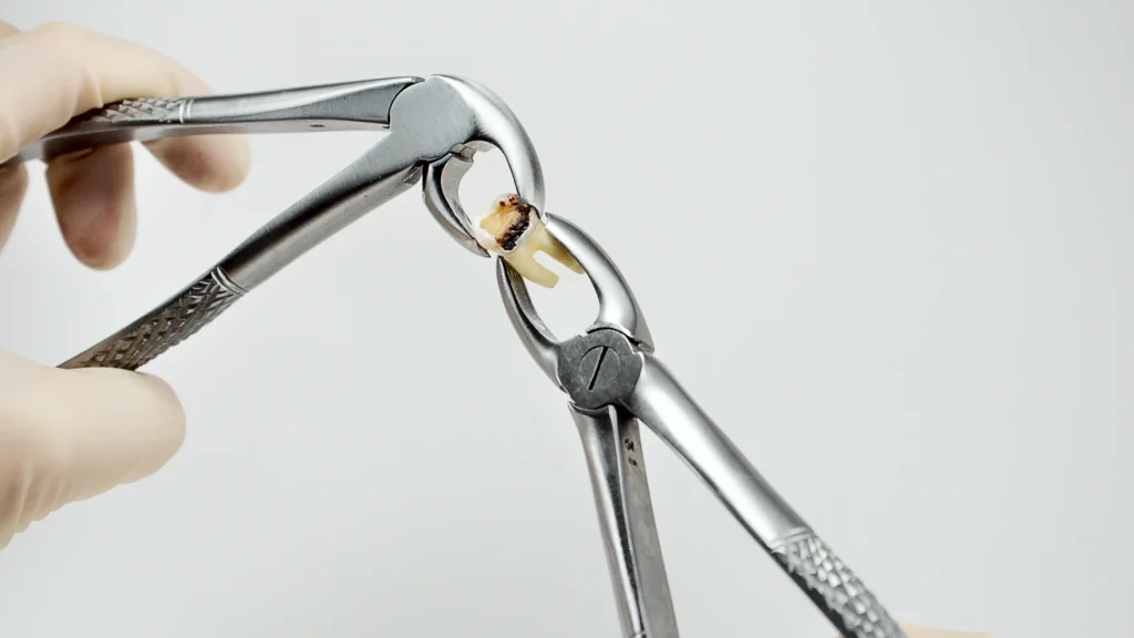 denizli diş çekimi