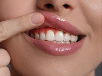 denizli diş eti tedavisi (periodontoloji)