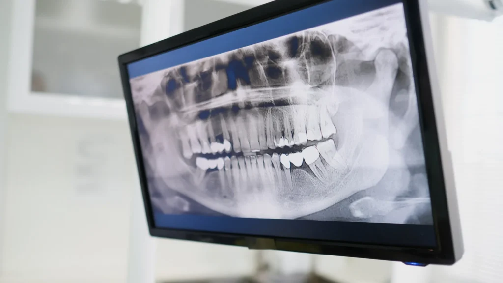 denizli ağız diş ve çene cerrahisi